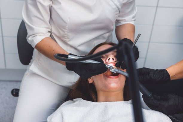 Best Emergency Dental Extractions in Fort Mill, SC
