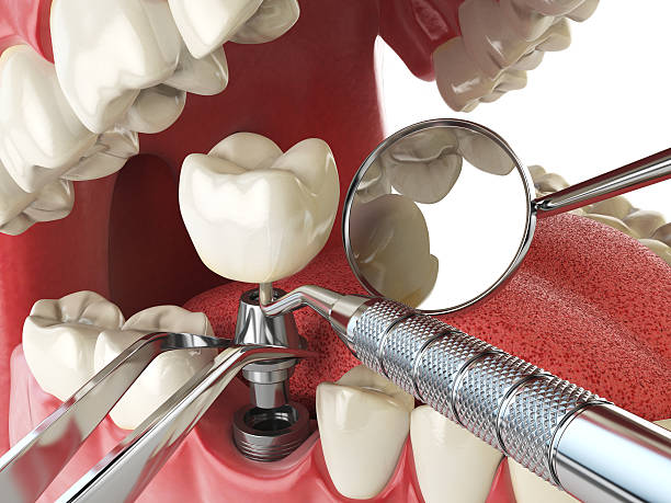 Best Mobile Emergency Dentist in Fort Mill, SC
